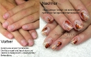 Vorher - Nachher_3